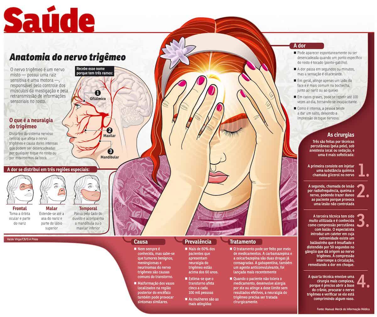 O que é Neuralgia do trigêmeo? O que causa a Neuralgia do trigêmeo