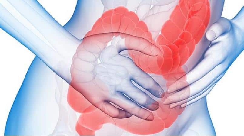 Síndrome do intestino irritável o que é causas sintomas e tratamento Clínica Dr Hong Jin